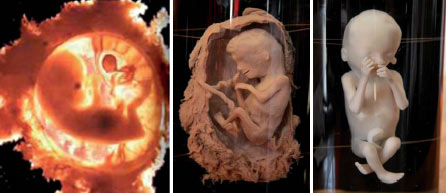 embrio